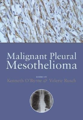 Malignant Pleural Mesothelioma 1st Edition(English, Hardcover, unknown)