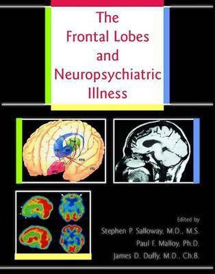 The Frontal Lobes and Neuropsychiatric Illness(English, Hardcover, unknown)