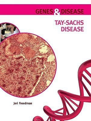 Tay-Sachs Disease(English, Hardcover, Freedman Jeri)