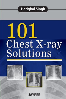 101 Chest X-Ray Solutions(English, Paperback, Singh Hariqbal)