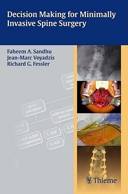 Decision Making for Minimally Invasive Spine Surgery(English, Paperback, unknown)