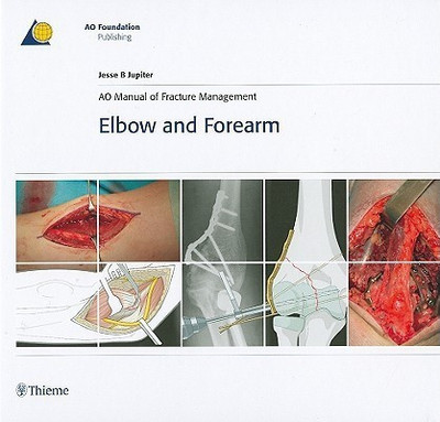 AO Manual of Fracture Management - Elbow & Forearm(English, Hardcover, Jupiter Jesse)