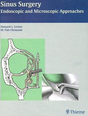 Sinus Surgery(English, Hardcover, unknown)