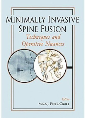 Minimally Invasive Spine Fusion: Techniques and Operative Nuances(English, Hardcover, unknown)