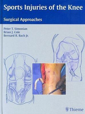 Sports Injuries of the Knee(English, Hardcover, unknown)