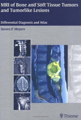MRI of Bone and Soft Tissue Tumors and Tumorlike Lesions(English, Hardcover, Meyers Steven)