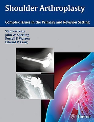 Shoulder Arthroplasty(English, Hardcover, unknown)