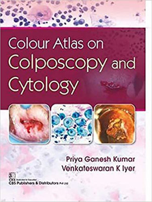 Colour Atlas on Colposcopy and Cytology(English, Paperback, Kumar Priya Ganesh)
