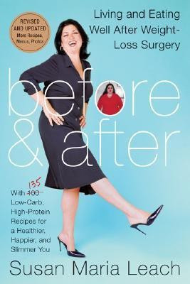 Before and After(English, Paperback, Leach Susan Maria)