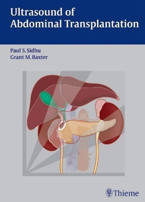Ultrasound of Abdominal Transplantation(English, Hardcover, unknown)