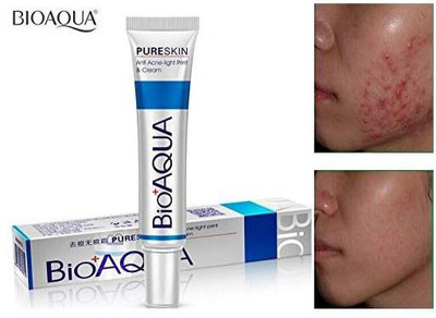 BIOAQUA Face care Acne Treatment Acne Treatment Cream Shrink pores Oil Control Skin care(30 g)