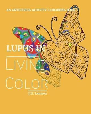Lupus in Living Color(English, Paperback, Johnson J H)