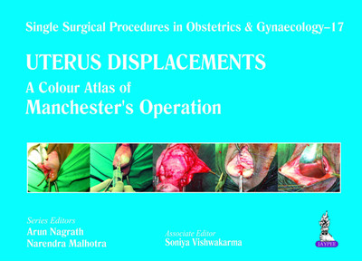 Single Surgical Procedures in Obstetrics and Gynaecology - 17 - UTERUS DISPLACEMENTS  - A Colour Atlas of Manchesters Operation 1st  Edition(English, Hardcover, unknown)
