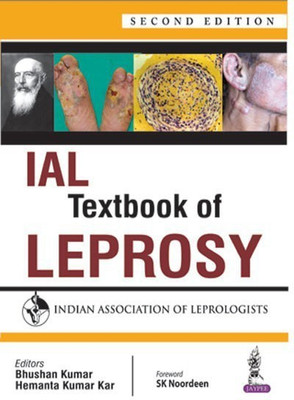 IAL Textbook of Leprosy(English, Hardcover, Kumar Bhushan)