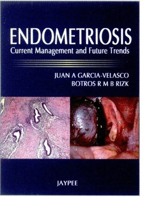 Endometriosis(English, Hardcover, Garcia-Velasco Juan A)