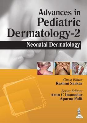 Advances in Pediatric Dermatology - 2(English, Paperback, Inamadar Arun C MD DVD)