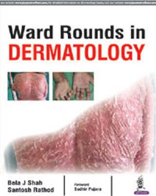 Ward Rounds in Dermatology  - ward raund in dermetology(English, Paperback, Shah Bela J)