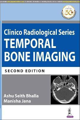 Clinico Radiological Series: Temporal Bone Imaging(English, Paperback, Bhalla Ashu Seith)