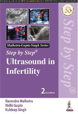 Step by Step Ultrasound in Infertility(English, Paperback, Malhotra Narendra)