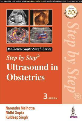 Step by Step Ultrasound in Obstetrics(English, Paperback, Malhotra Narendra)