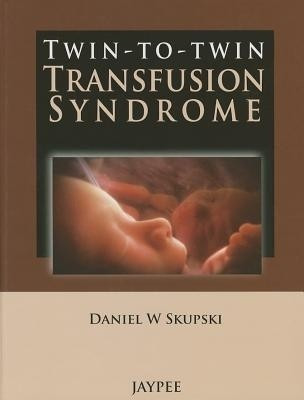 Twin-to-Twin Transfusion Syndrome 1st  Edition(English, Hardcover, Skupski Daniel W)