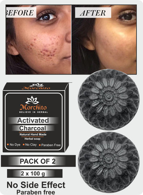 Morchito Activated Charcoal soap for Women, Anti Wrinkle, Pimples, Acne & Whitening Skin Care Soap.(2 x 100 g)