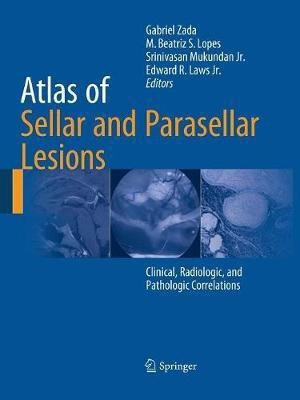 Atlas of Sellar and Parasellar Lesions(English, Paperback, unknown)