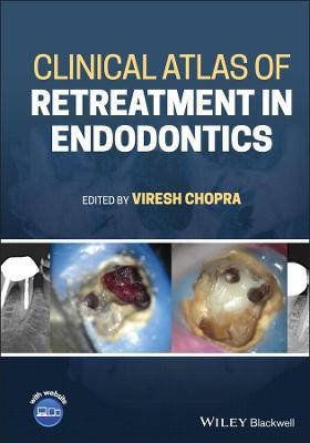 Clinical Atlas of Retreatment in Endodontics(English, Hardcover, unknown)