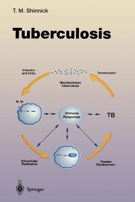 Tuberculosis(English, Paperback, unknown)