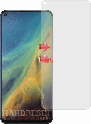 ZINGTEL Impossible Screen Guard for ZTE BLADE V2020 5G (Flexible Shatterproof)(Pack of 1)