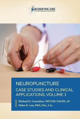 Neuropuncture Case Studies and Clinical Applications(English, Paperback, Corradino Michael D Dr)