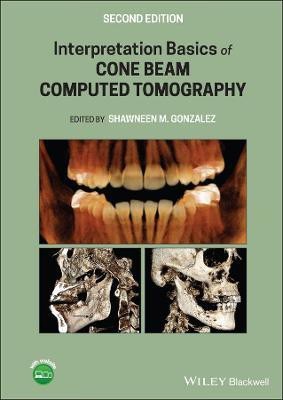 Interpretation Basics of Cone Beam Computed Tomography(English, Hardcover, unknown)