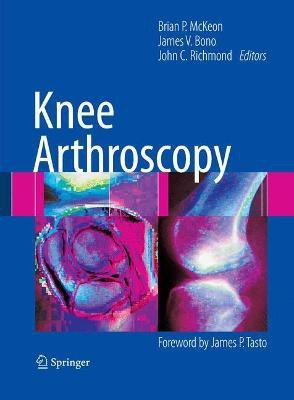 Knee Arthroscopy(English, Hardcover, unknown)