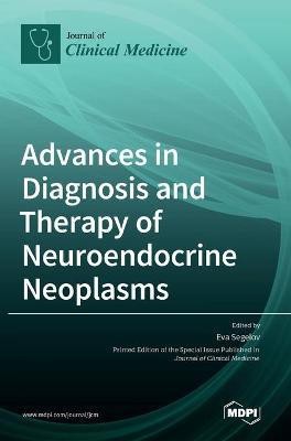 Advances in Diagnosis and Therapy of Neuroendocrine Neoplasms(English, Hardcover, unknown)