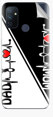 tiddler OnePlus Nord N100 Mobile Skin(White)