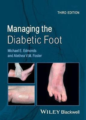 Managing the Diabetic Foot(English, Paperback, Edmonds Michael E.)