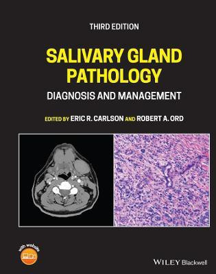 Salivary Gland Pathology(English, Hardcover, unknown)