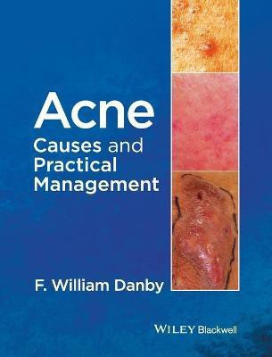 Acne(English, Hardcover, Danby F. William)