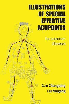 Illustrations Of Special Effective Acupoints for common Diseases(English, Paperback, unknown)