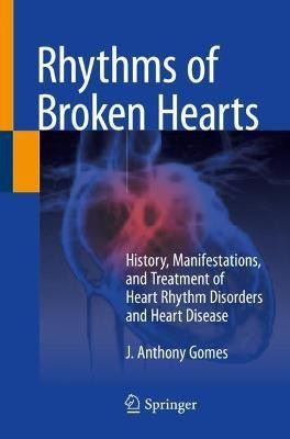 Rhythms of Broken Hearts(English, Paperback, Gomes J. Anthony)