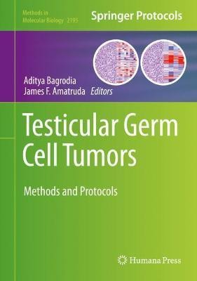 Testicular Germ Cell Tumors(English, Hardcover, unknown)