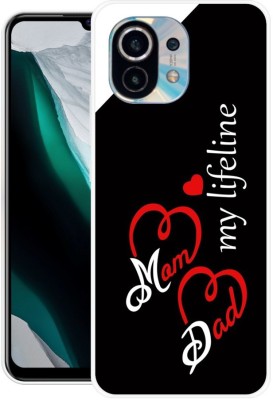 SIMAWAT Back Cover for Mi 11 Lite, Mi 11 Lite 5G(Black, White, Grip Case, Silicon, Pack of: 1)