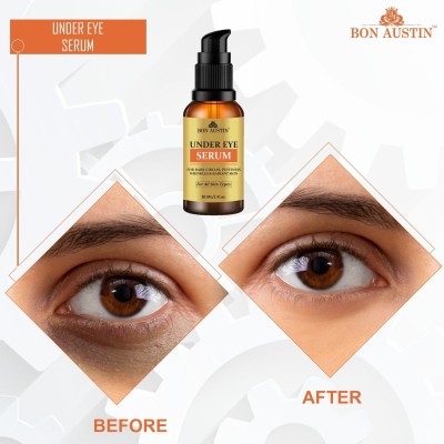 Bon Austin Premium Under Eye Serum To Reduce Dark Circles and Puffiness (30 ML)(30 ml)