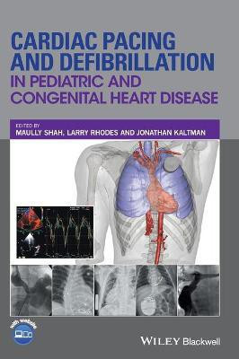 Cardiac Pacing and Defibrillation in Pediatric and Congenital Heart Disease(English, Hardcover, unknown)