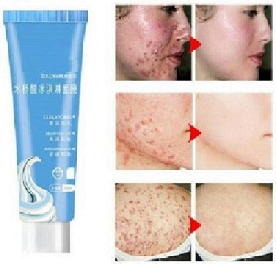 Elecsera Ice Cream Mask Ultra Cleansing, Brighten and Whiten(120 ml)