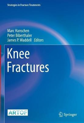 Knee Fractures(English, Hardcover, unknown)