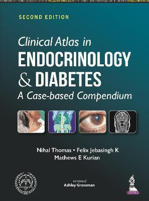 Clinical Atlas in Endocrinology and Diabetes(English, Paperback, Thomas Nihal)