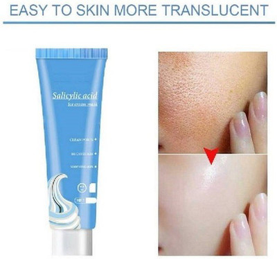 Elecsera Ice Cream Mask Ultra Cleansing,Brighten and whiten Clean Pose Blackhead Remover Mask(120 ml)