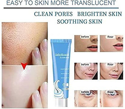 Elecsera Salicylic Acid Ice Cream Mask (Pack of 1)(120 ml)