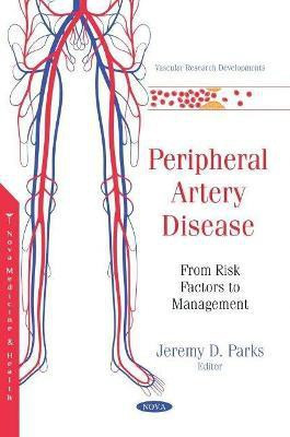 Peripheral Artery Disease(English, Paperback, unknown)